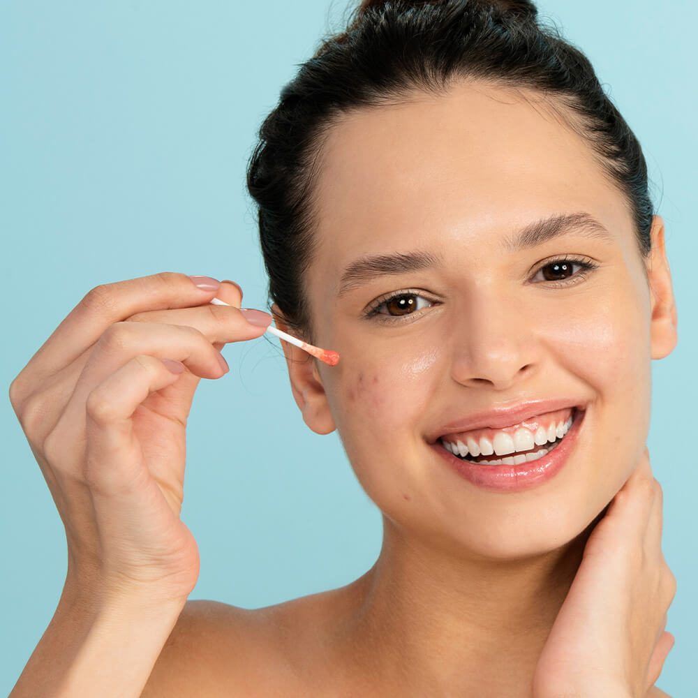 Loção Secativa de Espinhas - Drying Lotion 30ml - Imagem 5